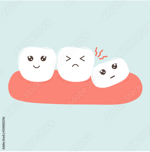 Impaction Teeth Illustration. Wisdom Teeth Eruption