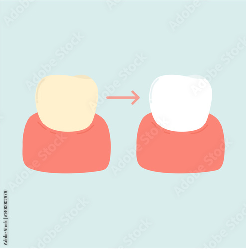 Bleaching and Whitening Teeth Illustration