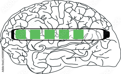 The image shows a black and white illustration of the brain with a horizontal progress bar partially filled with green.