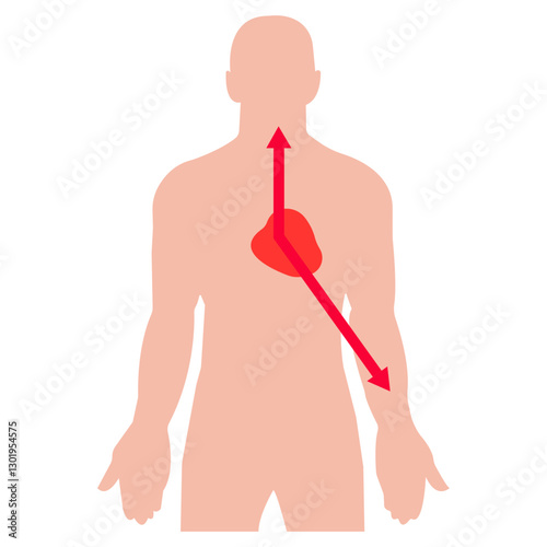 Angina Pectoris colored icon