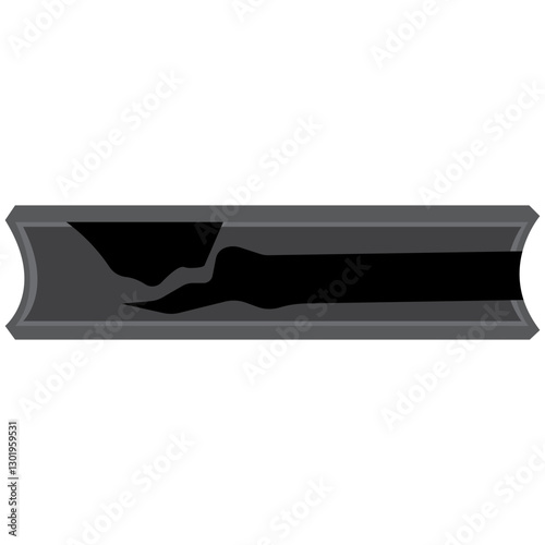 Atherosclerosis glyph icon