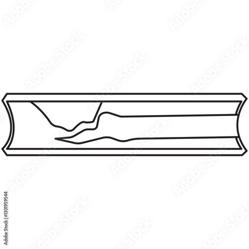 Atherosclerosis line icon