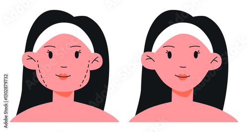 Woman Face Before and After Cosmetic Lift Surgery.