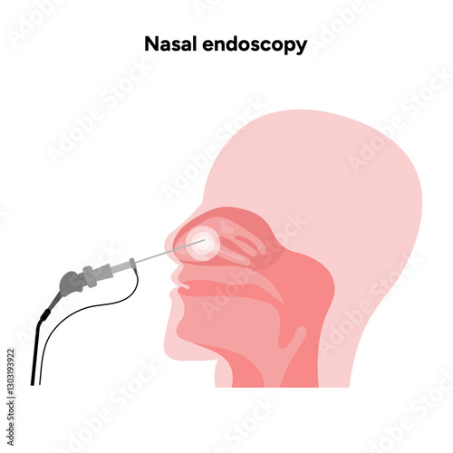 Nasal endoscopy procedure nasal and sinus passages. Thin, flexible tube with camera and light. Ear, nose, and throat. Medical diagram