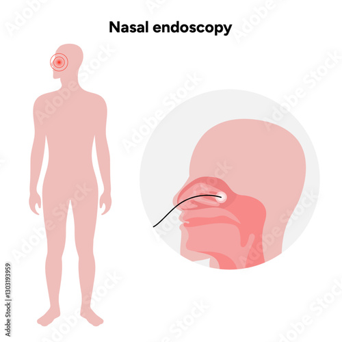 Nasal endoscopy procedure nasal and sinus passages. Thin, flexible tube with camera and light. Ear, nose, and throat. Medical diagram