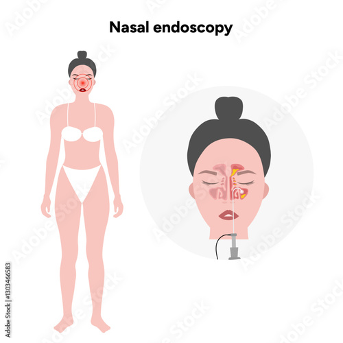 Nasal endoscopy procedure nasal and sinus passages. Thin, flexible tube with camera and light. Ear, nose, and throat. Medical diagram