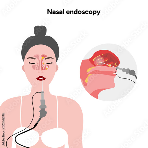 Nasal endoscopy procedure nasal and sinus passages. Thin, flexible tube with camera and light. Ear, nose, and throat. Medical diagram