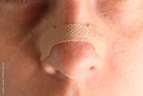 Woman with a nasal strip in the nose apply. Close view of a nasal strip in the nose