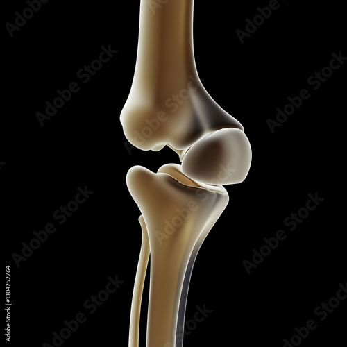 Elbow dislocation injury treatment. Joint recovery. Pain diagnosis. Digital 3D rendering of an elbow joint with visible dislocation details.