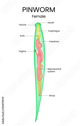 Diagram of Enterobius Vermicularis Anatomy
