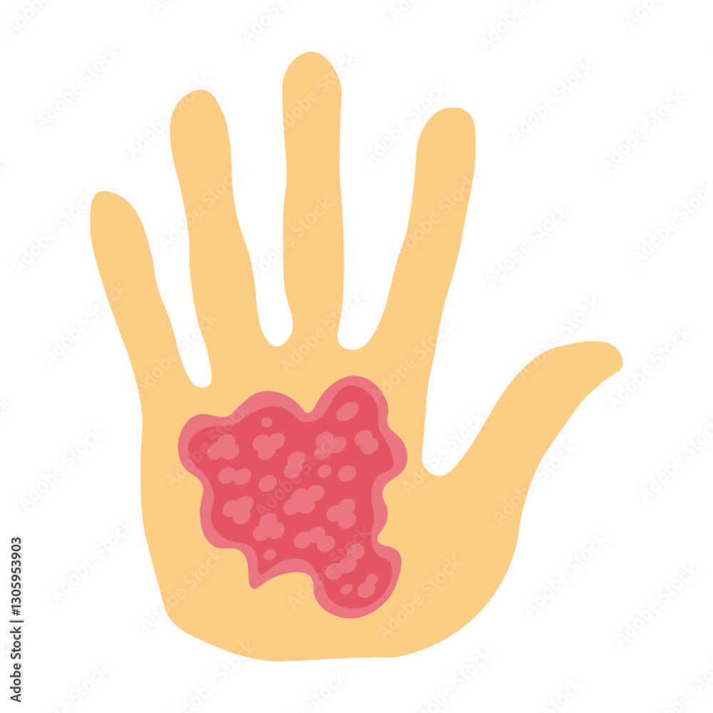 Fototapeta premium Eczema