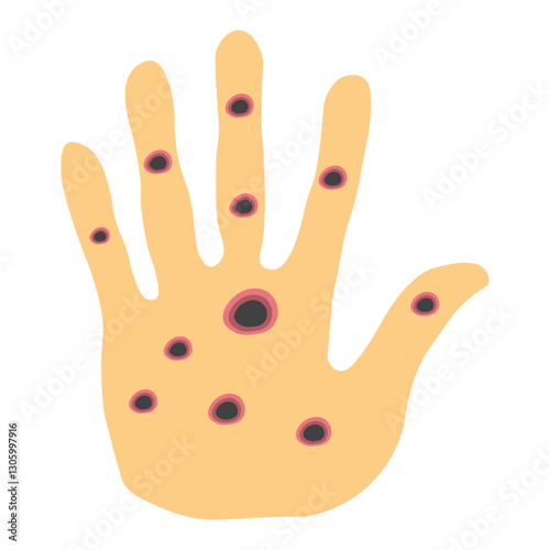 Monkeypox virus on skin 