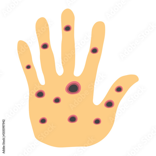 Monkeypox virus on skin 