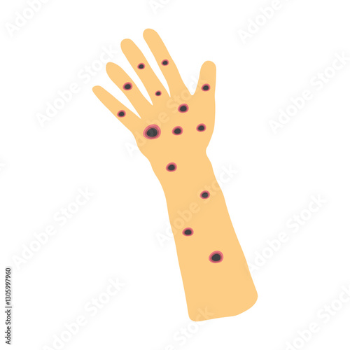 Monkeypox virus on skin 