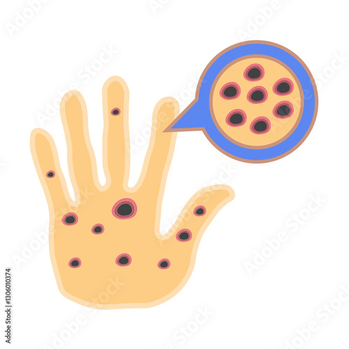 Monkeypox virus on skin 