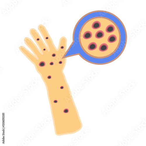 Monkeypox virus on skin 