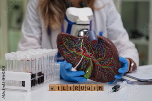 We are investigating bilirubin levels using a liver model and running blood tests in a controlled lab for accuracy photo