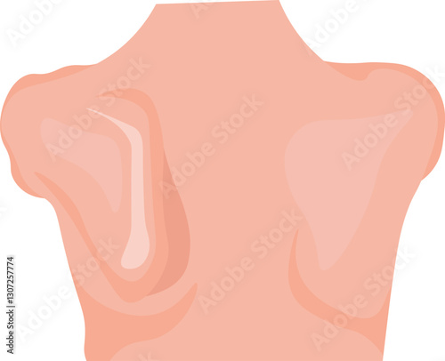 Winging of scapula