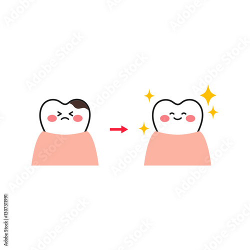 虫歯治療した歯のキャラクターのビフォーアフターのイラスト