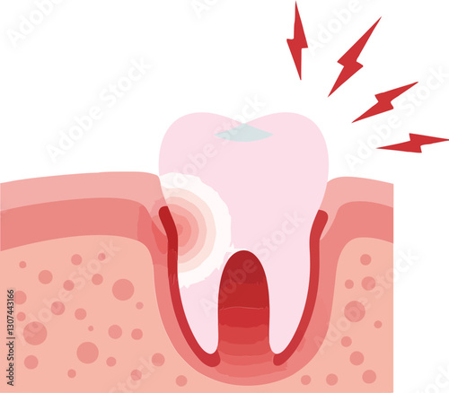Tooth with a cavity illustrated in a minimal style, depicting pain signals and surrounding gum tissue, showcasing flat vector art