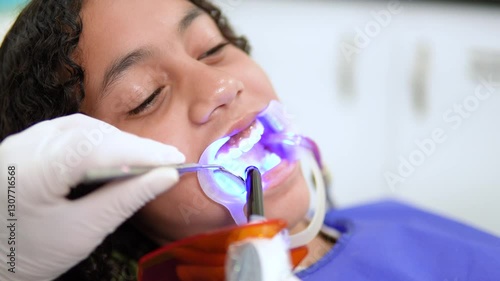 Detailed close-up of a dentist working on a teenage girls teeth in a dental clinic. The dentist is using a dental curing LED light to apply treatment, emphasizing the importance of oral health and pro