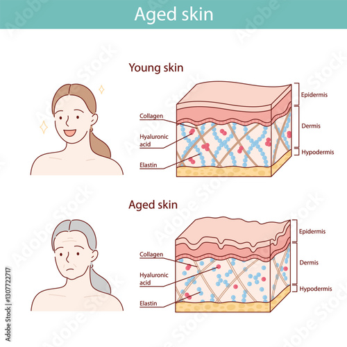 vector illustration of the skin aging process.