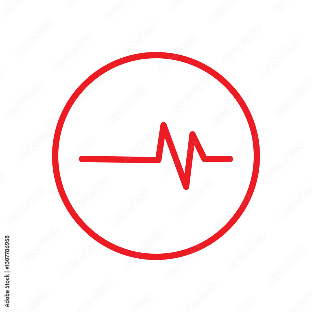 ECG SIGNS ECG SIGNS