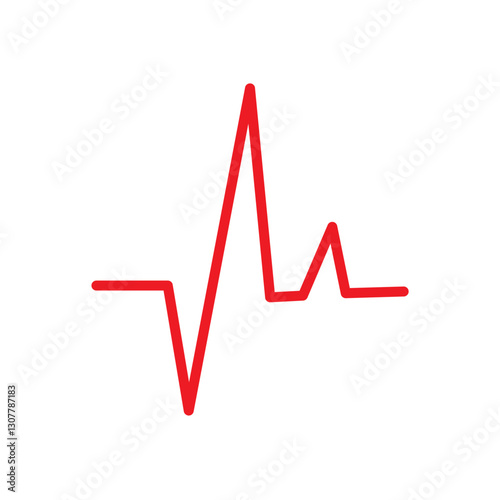 ECG SIGNS