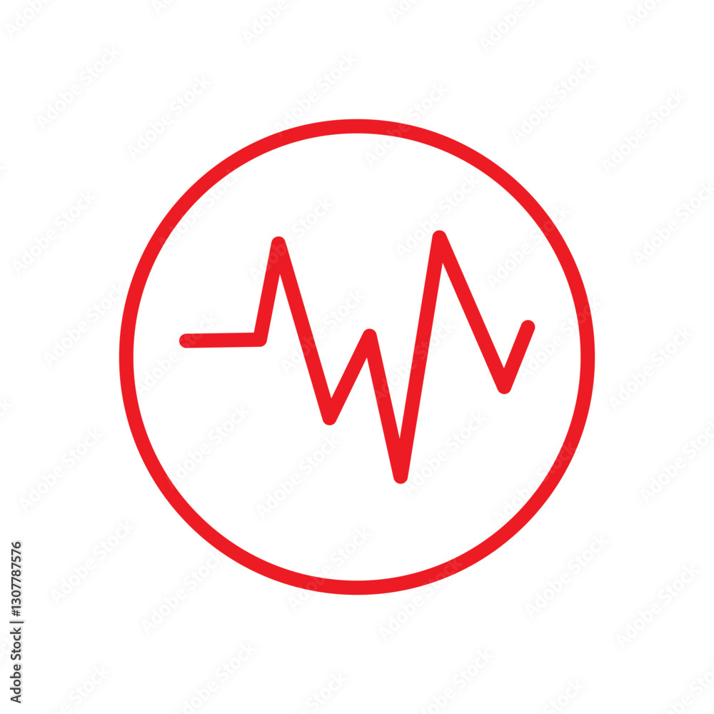 ECG SIGNS ECG SIGNS