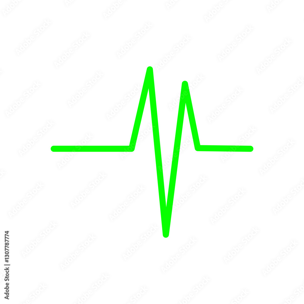 ECG SIGNS