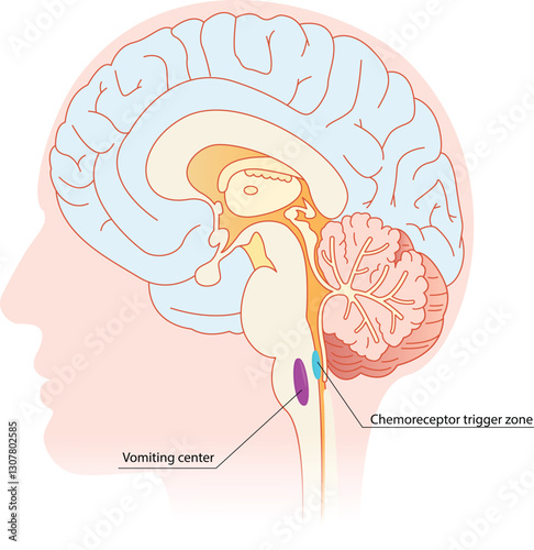 Vomiting center and chemoreceptors trigger zone anatomy. Schematic illustration of a brain with topography of CTZ and VC zones