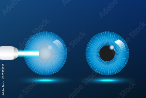 Glaucoma poster. Increased intraocular pressure, optic nerve damage, and vision loss. Blurred vision, deterioration of vision
