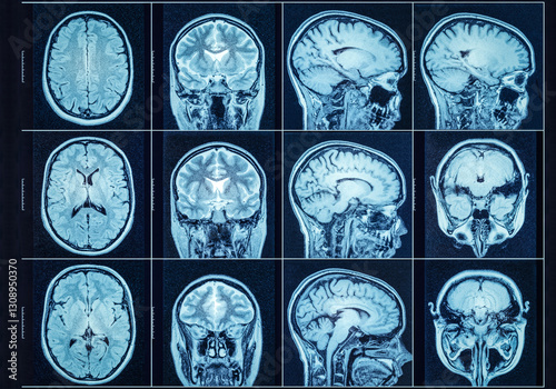 фотографія Closeup of a CT scan with brain