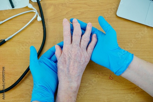 Arthritic Womens Hand with Bone Deformity