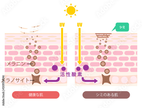 肌断面図で見せるシミのイラスト