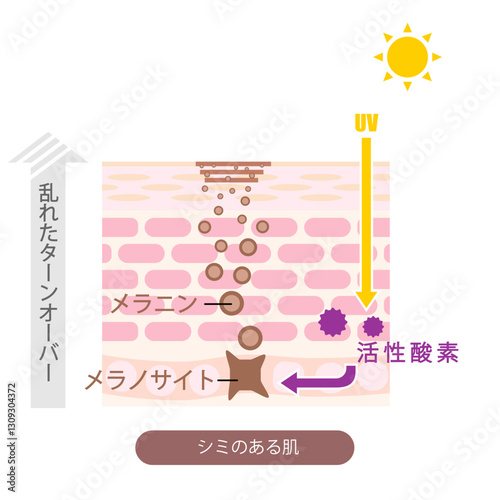 肌断面図で見せるシミのイラスト