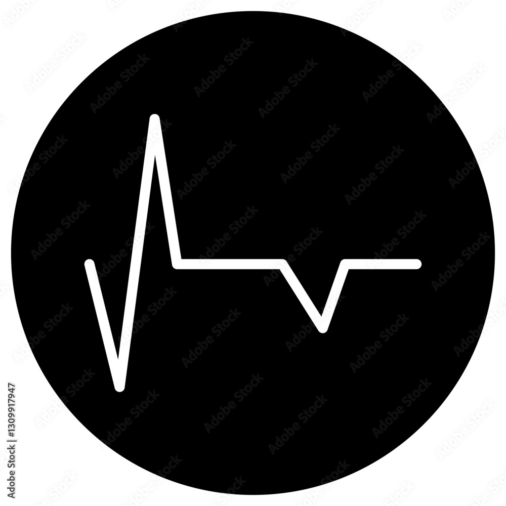 ECG sign
