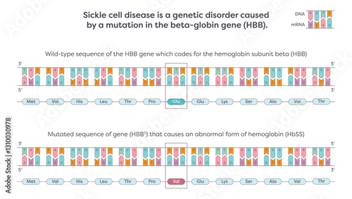 Sickle cell SNP mutation in the beta-globin HBB gene graphic illustration