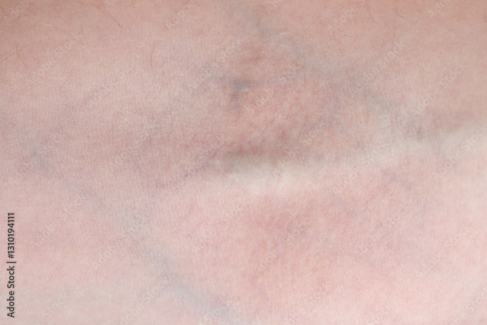 Texture of healthy skin as background, closeup Texture of healthy skin as background, closeup
