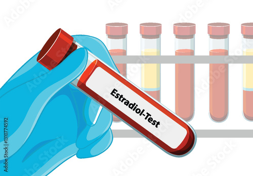 Medical Blood Test Illustration