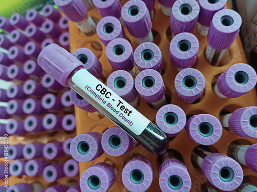 Photos Scientist holds Blood samples for Complete Blood Count (CBC)