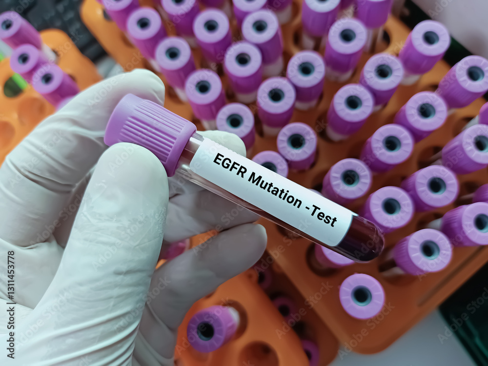 Fototapeta premium Lab Technologist holds blood sample for EGFR mutation test with laboratory background. Diagnosis of lung disease.
