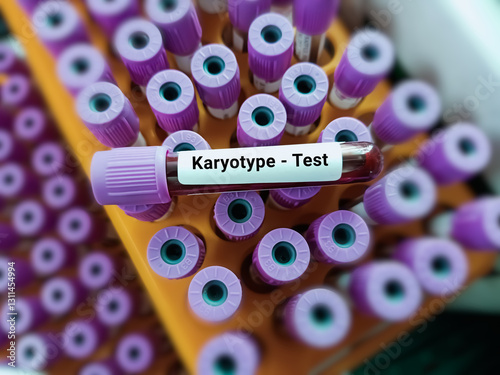 Blood sample for karyotyping test. Healthcare and medical test concept. photo