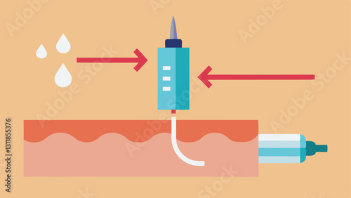 Syringe and Skin An illustration of a syringe injecting a serum into the skin with arrows indicating the tration and action of elastinboosting ingredients beneath the surface.