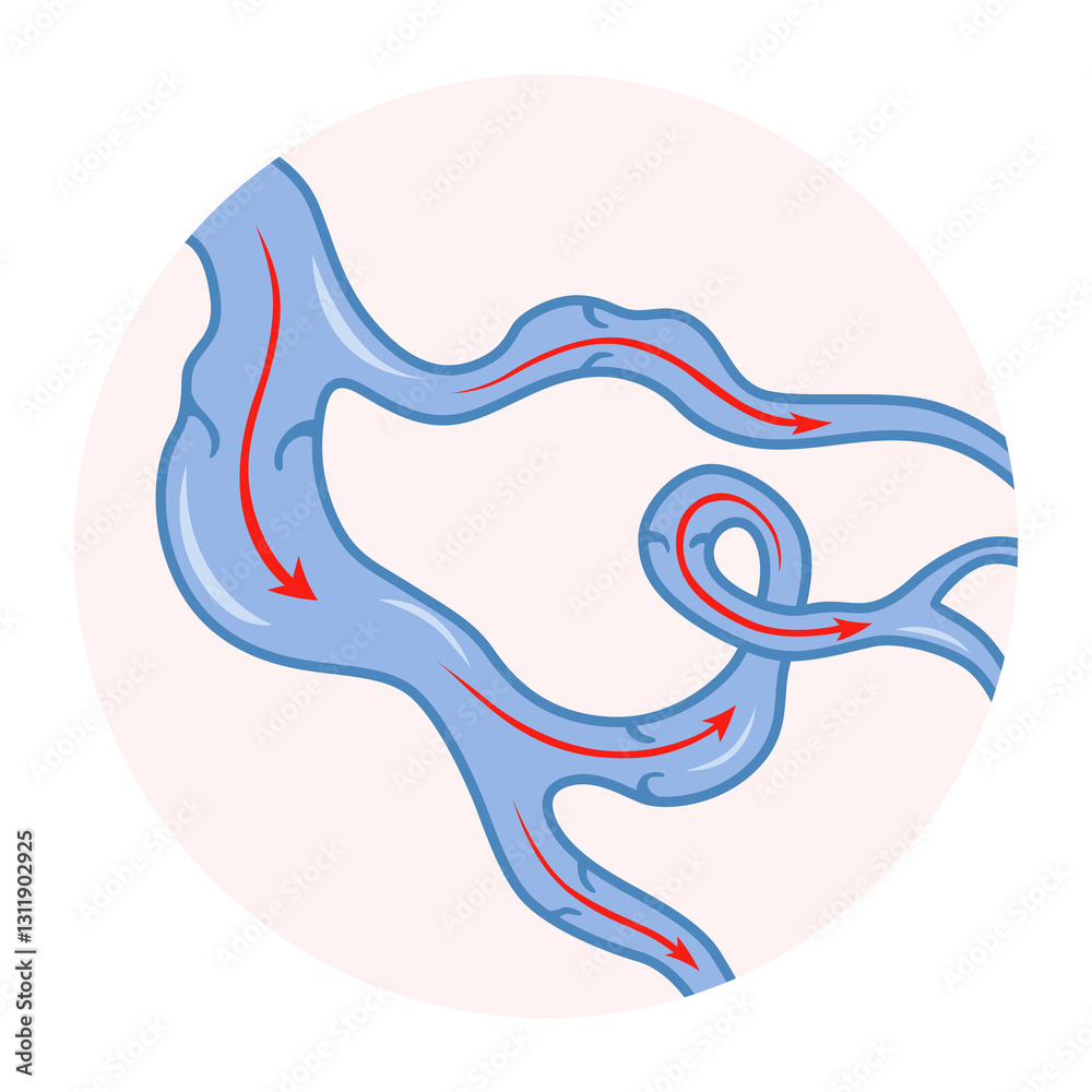 Varicose veins. Blue blood vessel visible through the skin. Vascular disease diagnostic and treatment. Venous insufficiency medical