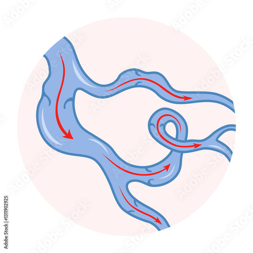 Obraz na płótnie Varicose veins. Blue blood vessel visible through the skin. Vascular disease diagnostic and treatment. Venous insufficiency medical w salonie