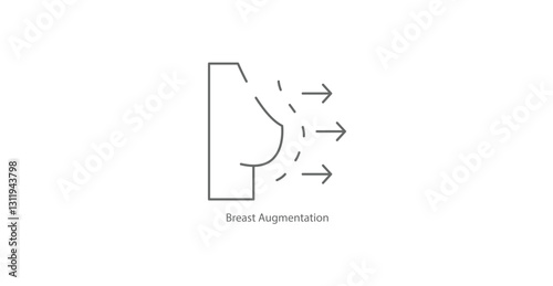Breast Augmentation Cosmetic Surgery Vector Illustration