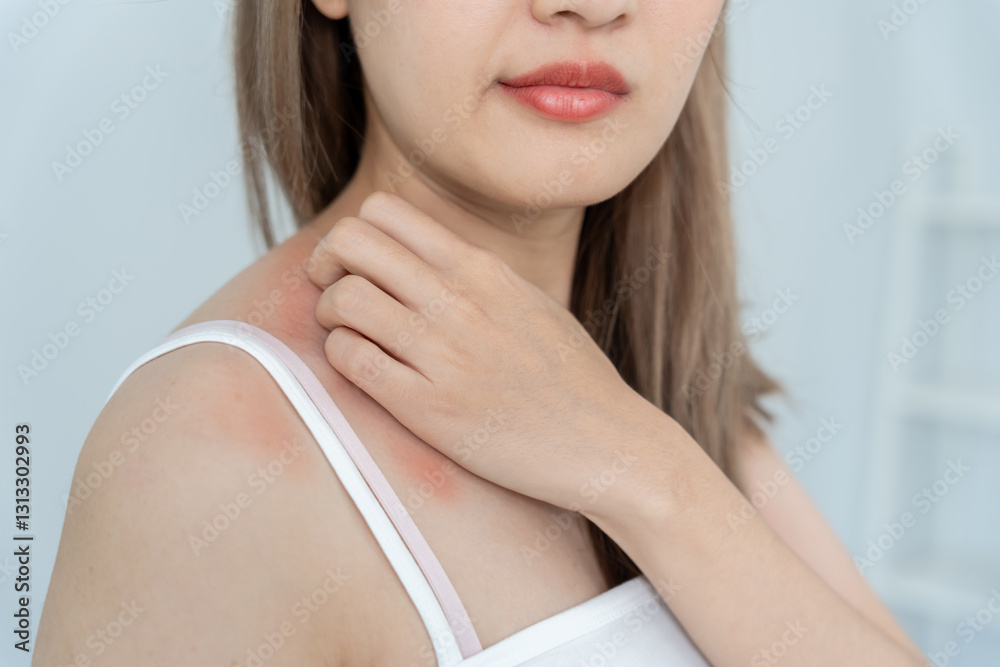 Fotografie skin problem and beauty