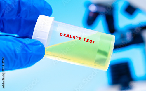 Measures oxalate levels, which may contribute to kidney
