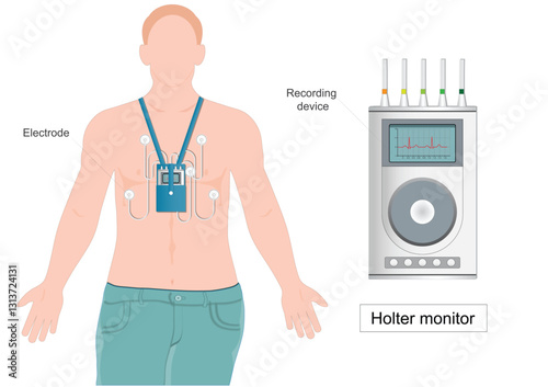 A Holter monitor (heart monitor)